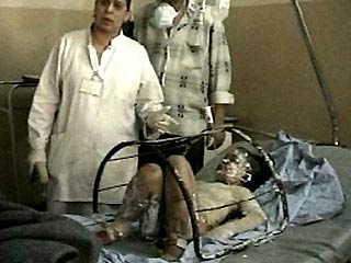 Больница Багдада, раненые дети