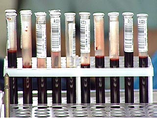 Изобретен бесконтактный способ анализа крови