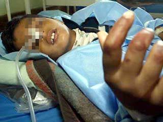 раненый ребенок был оперативно доставлен в одну из больниц Грозного, где от полученных ран скончался.