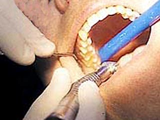 Жительница Германии была оштрафована на сумму в 100 евро из-за того, что ее восьмилетняя дочь отказалась открыть рот на приеме у школьного зубного врача