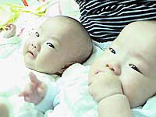 Сингапурские медики в ближайшие дни намерены провести новую операцию по разъединению сиамских близнецов - 4-месячных южнокорейских девочек, которые появились на свет сросшимися друг с другом в области поясницы