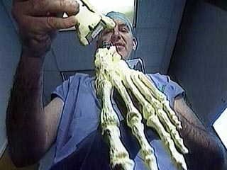 В США человеку успешно имплантирован протез руки, управляемый мыслями