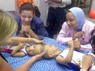 Американские врачи, которые провели операцию по разделению двух сиамских близнецов из Египта, сообщили, что, после нескольких дней искусственной комы мальчики пришли в сознание и двигают руками и ногами
