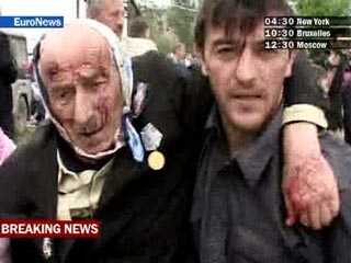 Число погибших в Грозном достигло 14 человек. Главе ОГВ взрывом оторвало ногу