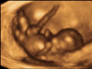 Новая техника ультразвукового исследования, созданная английским медиком, впервые позволила получить четкие фотографии 12-недельного человеческого плода в утробе матери