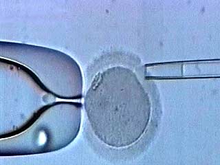 Британские ученые из Университета Ньюкасла получили разрешение клонировать человеческий зародыш для медицинских исследований