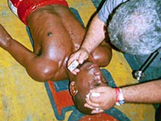 В Панаме боксер умер после нокаута