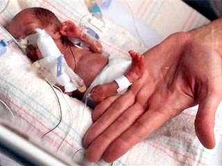 В больнице Чикаго готовят к выписке самого маленького ребенка в мире. Девочка Румаиса родилась значительно раньше положенного срока, и, к удивлению врачей, выжила. Ее вес составляет 227 грамм - это меньше, чем весит банка газировки