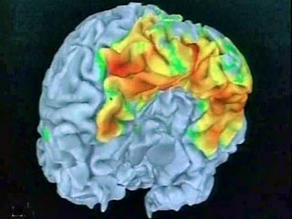 Благодаря мониторингу изменения частоты мозговых импульсов можно измерить либидо человека, утверждается в новом исследовании, проведенном израильским доктором Йорамом Варди из больницы в израильском городе