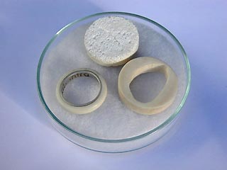 В Великобритании обручальные кольца будут изготовлять из клеток костной ткани молодоженов