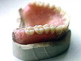 Зубные протезы: виды, цены, фото | Сити Дентал
