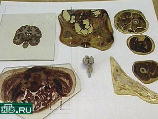 Новосибирских таможенников собираются привлечь к дисциплинарной ответственности за то, что 16 октября 2000 года они приняли для таможенного оформления 56 анатомических препаратов целого человеческого тела и 440 - человеческих мозгов.