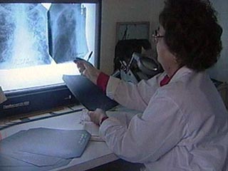 ВОЗ: официальные данные о заболеваемости туберкулезом в России сильно занижены