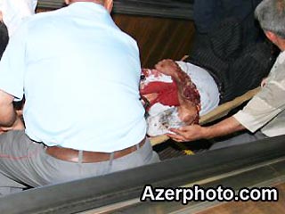 В бакинском метро из-за аварии эскалатора пострадали несколько десятков человек