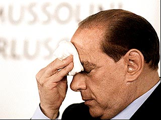 Премьер-министру Италии Сильвио Берлускони сделана пересадка волос
