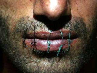 Заключенные тюрьмы в Батуми зашили себе рты в знак протеста