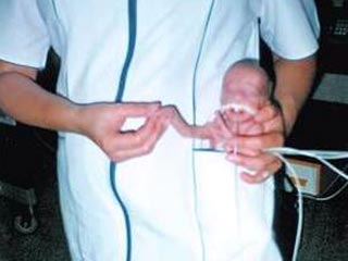 Скандал в Польше: медсестры в роддоме издевались над новорожденными (ФОТО)