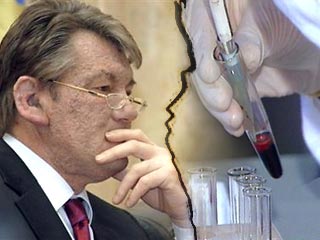 Президент Украины Виктор Ющенко сдал кровь для проведения анализов в рамках расследования его отравления. Отбор образцов крови проводили накануне украинские специалисты с привлечением иностранных экспертов