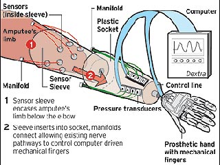 Доктор Уильям Крелиус и его команда в Университете Рутгерса создали бионическую руку Dextra, которая с помощью наличествующих у человека нервных путей контролирует отдельные, управляемые компьютером, механические пальцы