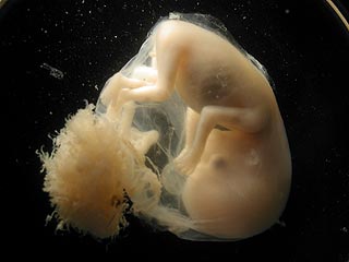 Ученые из США утверждают, что им удалось создавать стволовые клетки, не причиняя вреда человеческому эмбриону