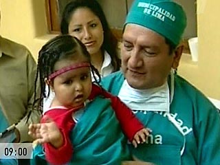 Двухлетняя перуанка Милагрос Серрон, известная как "маленькая русалка", родилась со сросшимися нижними конечностями - это редкое заболевание называется "синдром русалки" или сиреномелия