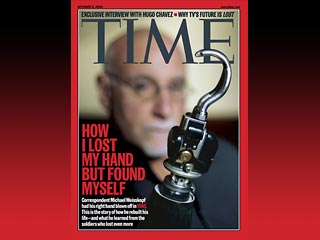 Корреспондент журнала Time Майкл Вайскопф, работая в Ираке потерял руку, когда пытался выбросить гранату из военного "Хаммера", на котором он ехал вместе с группой американских солдат