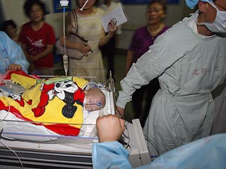 Китайские хирурги успешно разделили сиамских близнецов, сросшихся в области нижней части живота. Сестры в возрасте 28 дней стали самыми маленькими пациентками, подвергшимися сложнейшей и рискованной операции