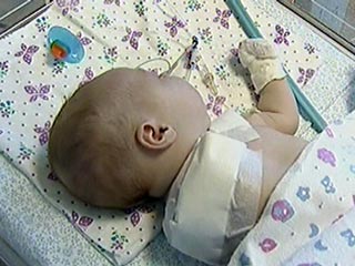 В Краснодаре 2-месячной девочке по халатности врачей ампутировали руку