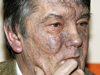 Ющенко вспоминает о своем отравлении, фото 2004 года