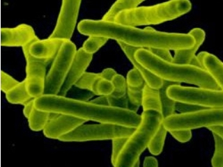 Ученые в ЮАР смогли полностью разгадать генетический код наиболее опасной разновидности туберкулеза, устойчивой к лекарствам
