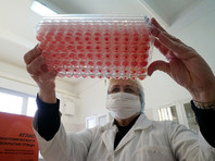 В Подмосковье изолировали 14 человек из-за вспышки птичьего гриппа