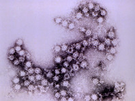 Вирус Коксаки относится к энтеровирусам, группе острых заболеваний, характеризующихся многообразием клинических проявлений от легких лихорадочных состояний до тяжелых менингитов. Передается воздушно-капельным, бытовым путем, а также через воду
