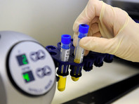 Роспотребнадзор предложил регулировать деятельность лабораторий, работающих с биоматериалами