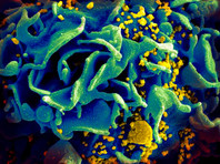 Ведомство также отмечает тенденцию к постепенному распространению лекарственной устойчивости вируса среди так называемых наивных пациентов, то есть тех больных, которые ранее не принимали лекарства от ВИЧ