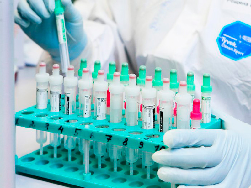 Департамент здравоохранения Москвы подтвердил большое количество ложноотрицательных тестов на коронавирус 