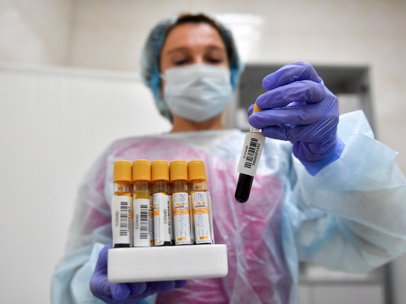 В России отмечено наибольшее число новых случаев коронавируса с середины августа