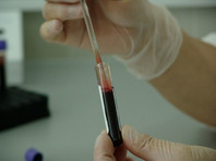 Пациенты с ВИЧ жалуются на нехватку лекарств и проблемы с тестами на фоне пандемии коронавируса