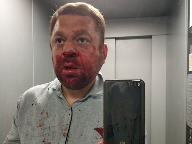 В ХМАО избит оппозиционный журналист Антон Пантин