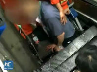 В Китае пенсионер сломал бедро, застряв в эскалаторе торгового центра