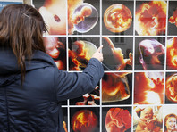 ВОЗ: каждая вторая женщина, решившаяся на аборт, подвергает свою жизнь опасности