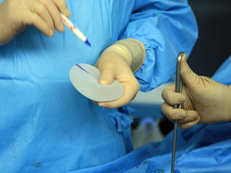 Департамент здравоохранения индийского штата Тамил-Наду анонсировал запуск программы, в рамках которой малоимущие смогут бесплатно вставить грудные импланты и изменить размер груди
