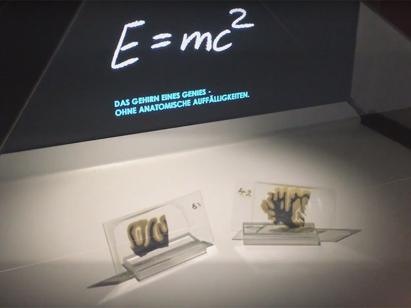 В Германии открылась временная экспозиция с фрагментами мозга Эйнштейна
