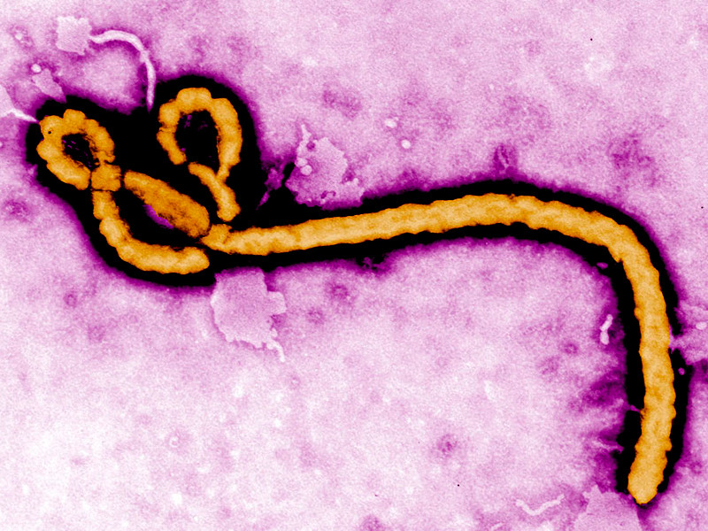 Власти ДРК подтвердили 13 случаев заражения вирусом Эбола

