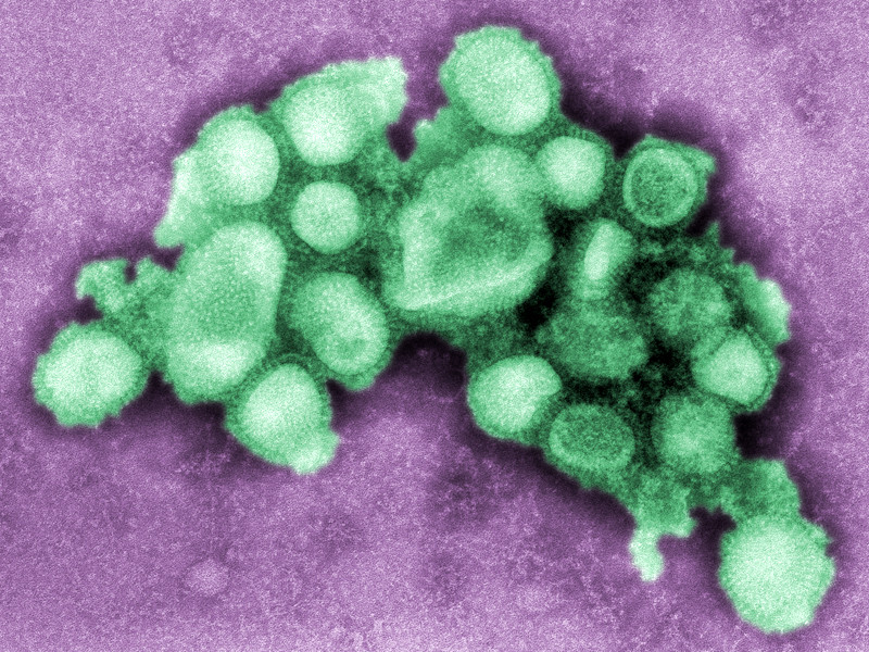 В Грузии число смертельных случаев заболевания вирусом гриппа H1N1 (подтип вируса гриппа А, известный, как свиной грипп) достигло восьми
