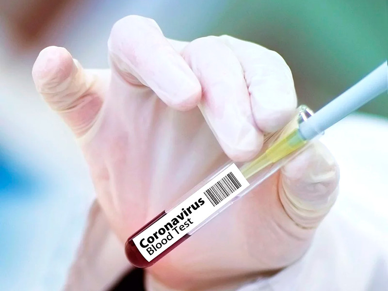 Более 20 тысяч человек согласились заразиться вирусами, схожими с COVID-19, в рамках программы британской исследовательской группы hVIVO по разработке вакцины от коронавируса

