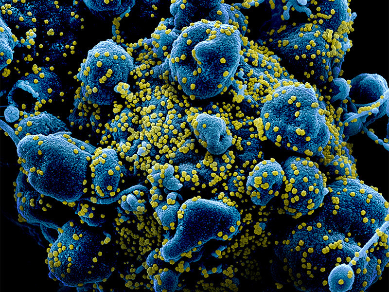 Правительство Германии и руководство 16 федеральных земель приняло решение запретить людям собираться больше двух из-за пандемии коронавируса


