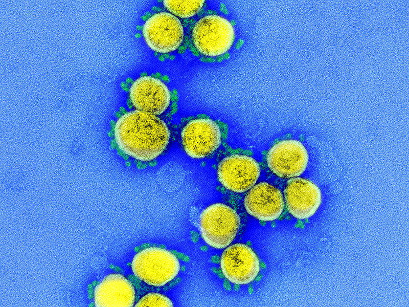 Ученые из Университета Гонконга выяснили температуры, при которых новый коронавирус COVID-19 наиболее и наименее активен