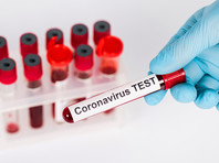 Одной из таких мер по предотвращению распространения коронавируса может стать введение особых биологических удостоверений личности или "иммунных паспортов", свидетельствующих, что человек не является носителем вируса или в его крови уже есть антитела

