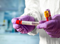 Генетик и вирусолог Пекова предупреждает: экспресс-тесты на коронавирус за 10-30 минут не дают точного результата, нужен ПЦР-тест