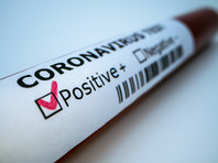 В США у более сотни детей коронавирус вызвал опасный воспалительный синдром - иммунитет "съедает" внутренние органы